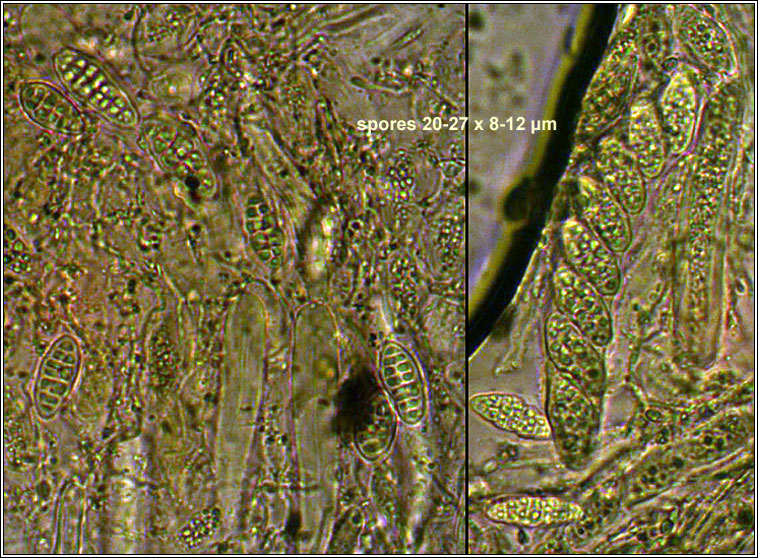 Gloniopsis praelonga, ascospores