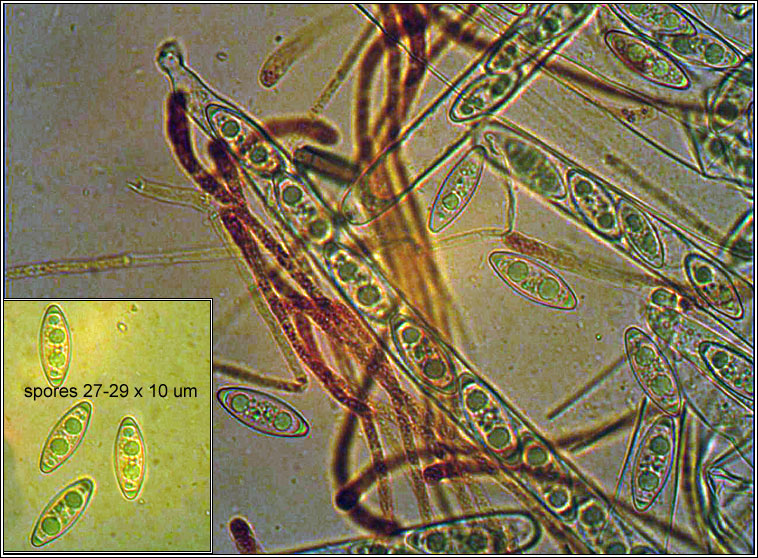 Byssonectria terrestris