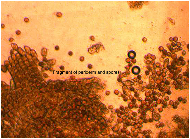 Groundsel Rust, Puccinia lagenophorae, aeciospores