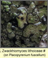Zwackhiomyces sphinctrinoides