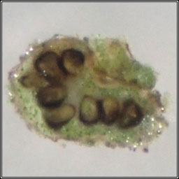 Lichenochora hyperphysciae