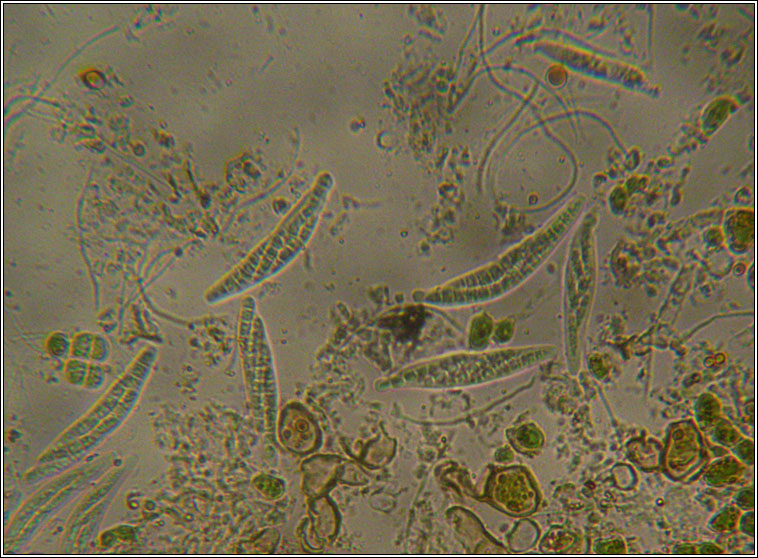 Fellhaneropsis myrtillicola