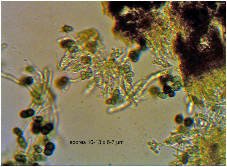Acolium sessile, Cyphelium sessile, spores