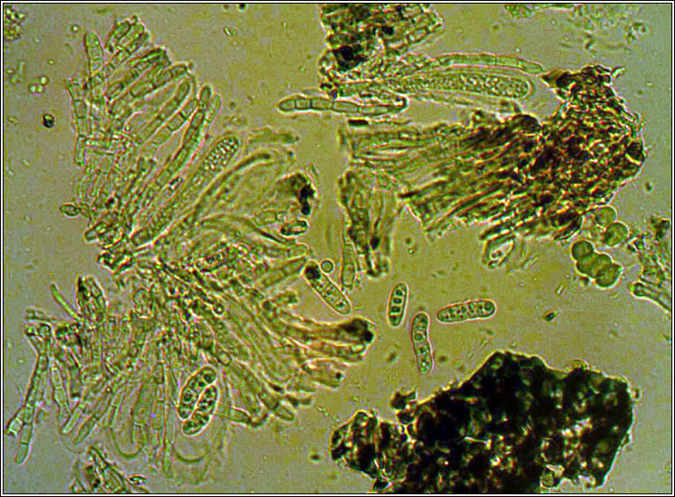 Placynthium nigrum