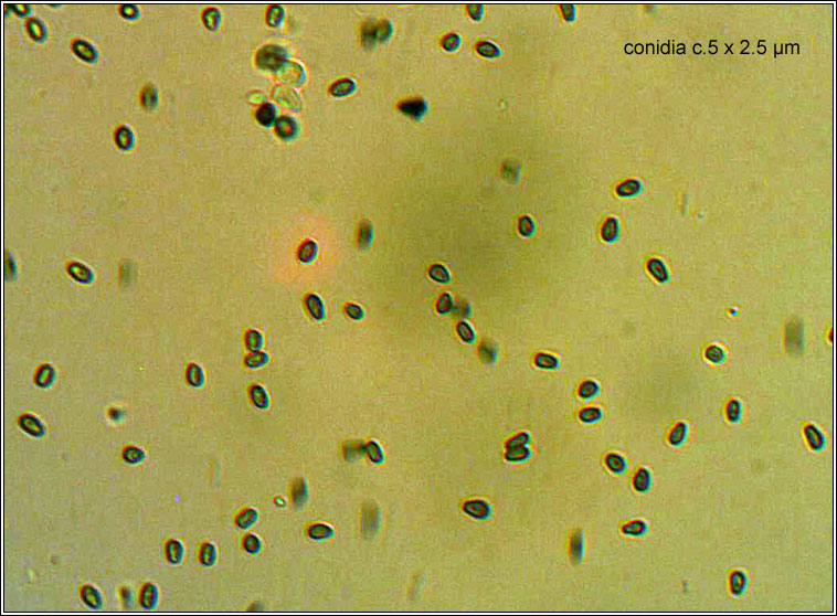 Laeviomyces pertusariicola