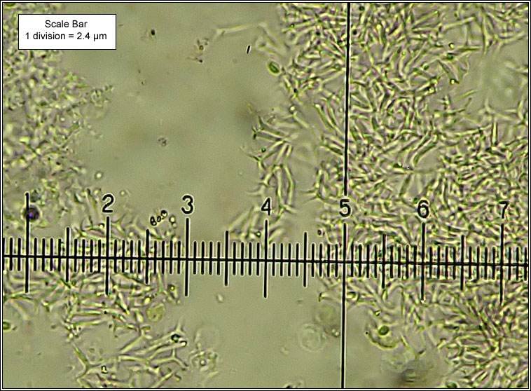 Spirographa ciliata, Cornutispora ciliata