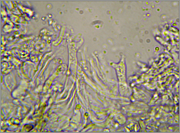 Zyzygomyces aipoliae