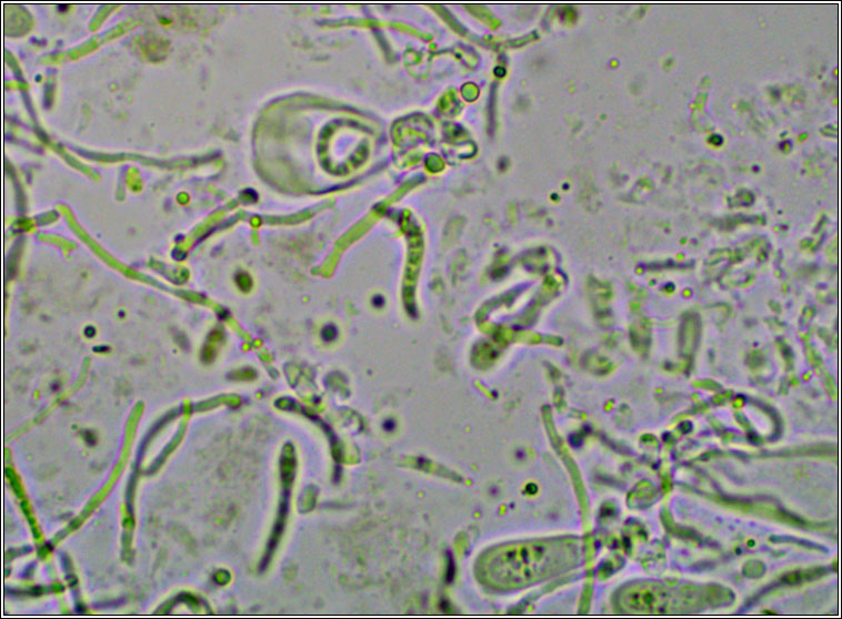 Scoliciosporum sarothamni
