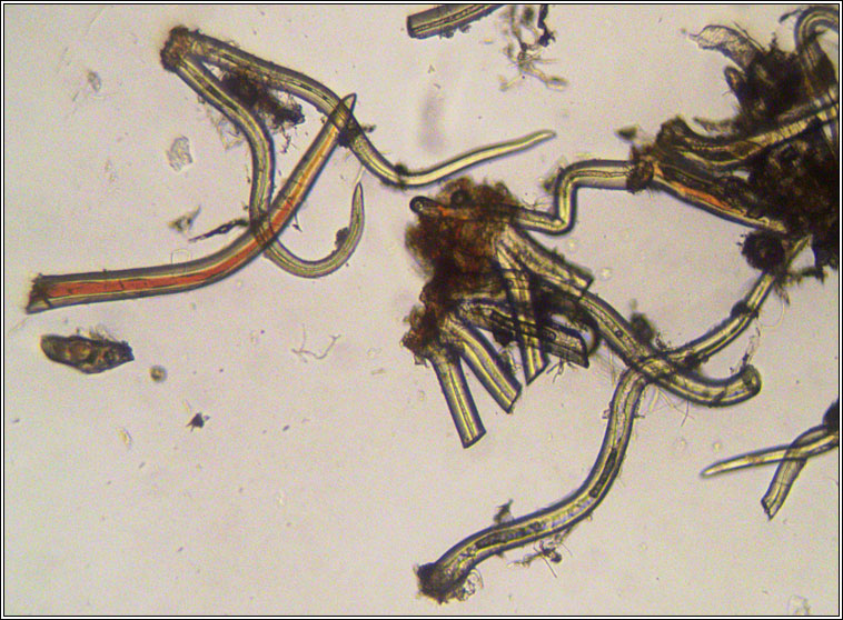 Eriophyes tiliae (tomentosae)