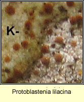 Protoblastenia lilacina