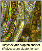 Didymocyrtis slaptoniensis (Polycoccum slaptoniense)