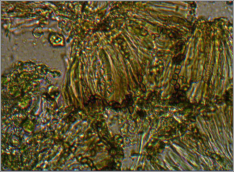 Intralichen lichenum