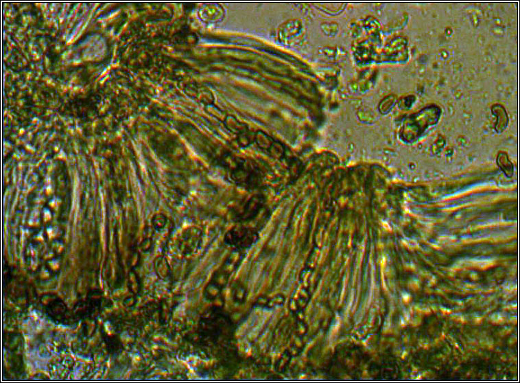 Intralichen lichenum