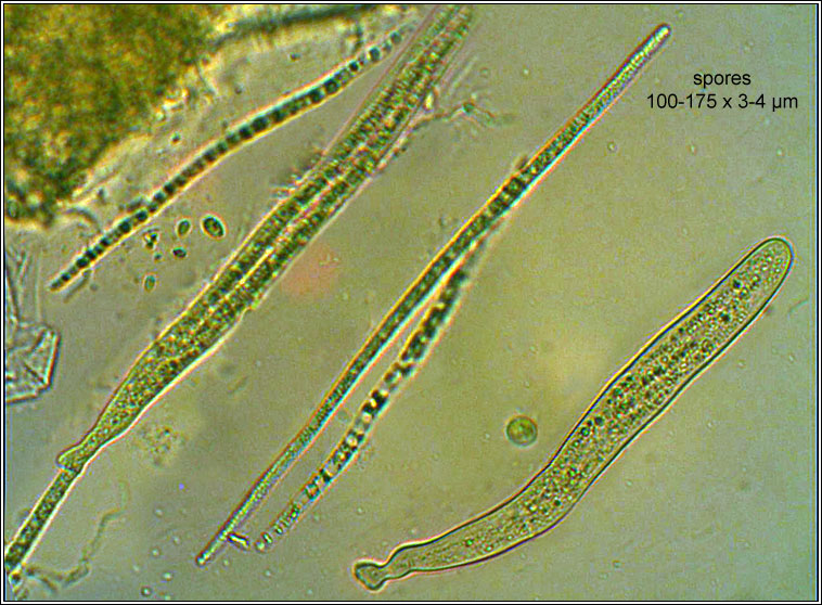 Tubeufia heterodermiae